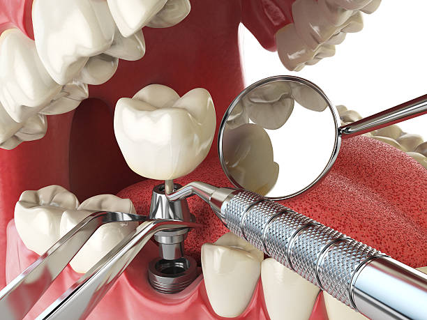 Best Orthodontic Emergency Dentist in Tariffville, CT