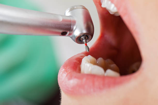 Best Emergency Cosmetic Dentistry in Tariffville, CT